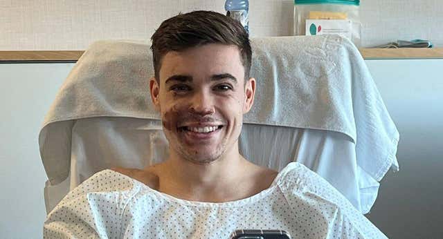 El Joel Plata más sincero publica imágenes de su durísima recuperación: «Esta mierda no me define»
