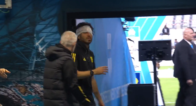 Se suspende el Marsella – Lyon: Fabio Grosso, herido tras ser destrozado el autobús del Olympique Lyon en su llegada al Vélodrome