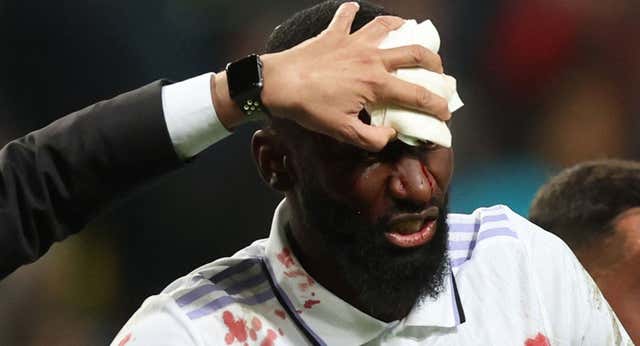 Cuando 20 puntos en la cabeza de Rüdiger ‘ayudaron’ a Felipe Segura a ser el nuevo jefe médico del Real Madrid: «Hay que coser por dentro»