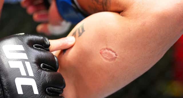 Un mordisco a lo Tyson termina en un tatuaje, un bonus de 50.000 dólares y una sanción de por vida