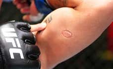 Un mordisco a lo Tyson termina en un tatuaje, un bonus de 50.000 dólares y una sanción de por vida
