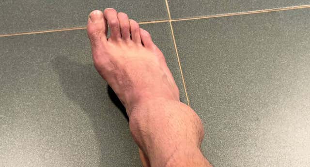La horrible lesión de una de las promesas del tenis francés en Barcelona