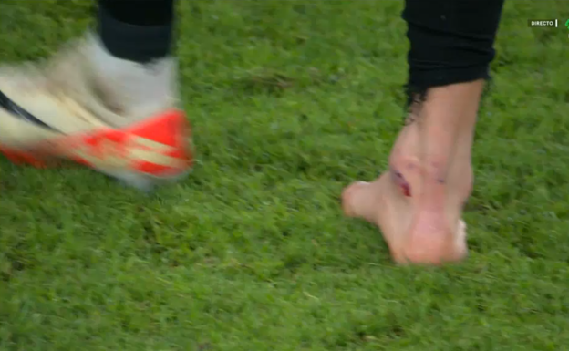 Así se le quedó el tobillo a Yuri Berchiche tras la entrada de Bruno Méndez.  MOVISTAR