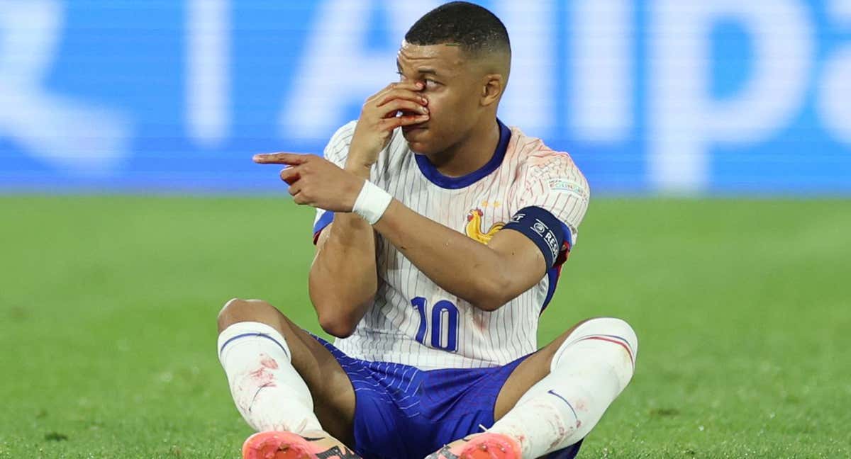 Kylian Mbappé, durante el Francia-Austria, después de su rotura del tabique nasal. /GETTY