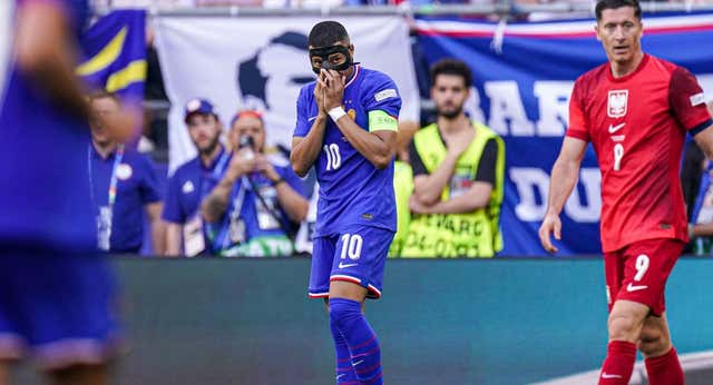 Deschamps se toma a risa el ‘tostón’ de Francia: «No estoy decepcionado»