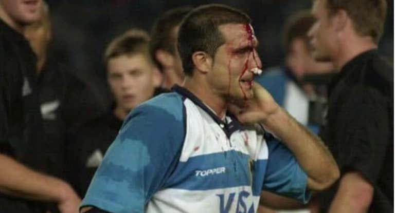 Liso ante los All Blacks.