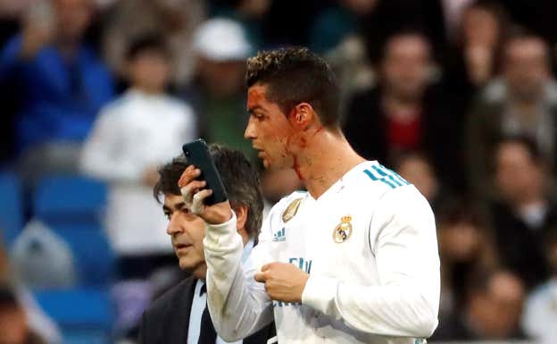 Cristiano Ronaldo se mira una herida con el móvil.  EFE