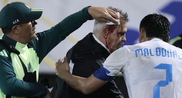 Honduras jugará su próximo partido a puerta cerrada tras el botellazo a Javier Aguirre