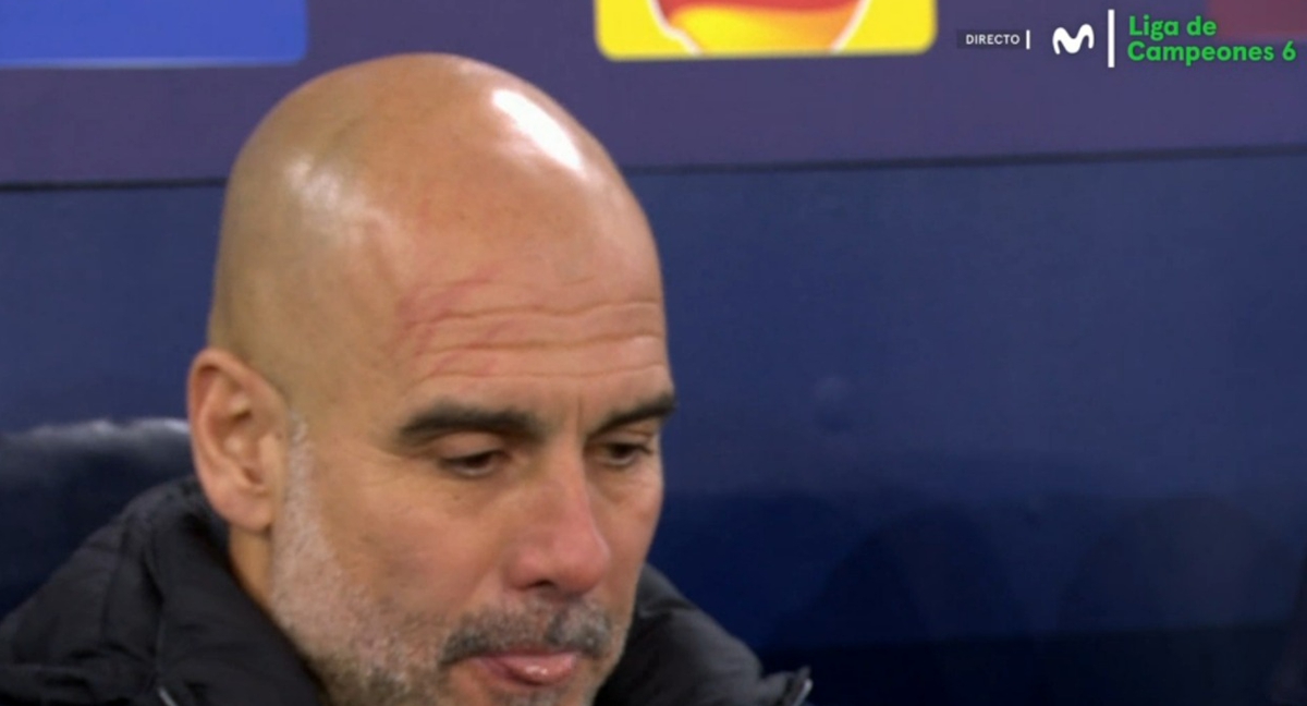 Pep Guardiola, con arañazos en la cara, en el partido contra el Brujas.