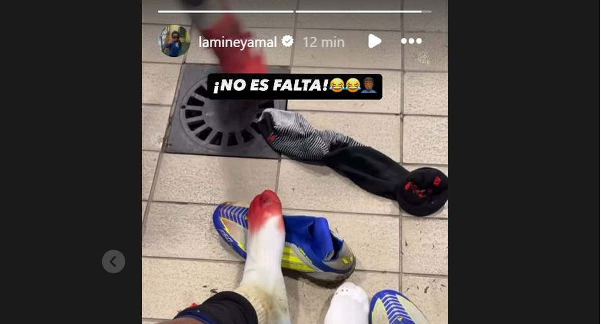 Lamine Yamal, con el pie ensangrentado después de jugar ante el Las Palmas./