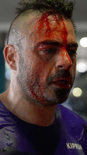 Valentí acabó con un corte en la cabeza después de chocar contra una columna.  VALENTÍ SANJUAN
