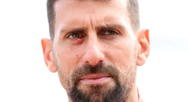 Un orzuelo debilita a Novak Djokovic antes de Montecarlo: «Mis expectativas no son muy altas»